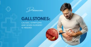 Gallstones: Causes, Symptoms And When Surgery Is Needed