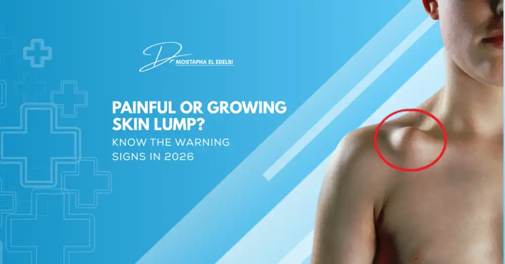 Painful-or-Growing-Skin-Lump-Know-the-Warning-Signs-in-2026