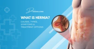 What Is Hernia? Causes, Types, Symptoms & Treatment Options