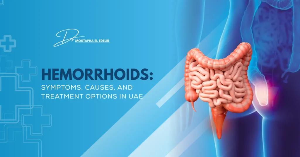 Hemorrhoids-Symptoms-Causes-and-Treatment-Options-in-UAE
