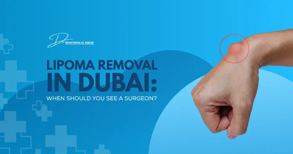 Lipoma-Removal-in-Dubai