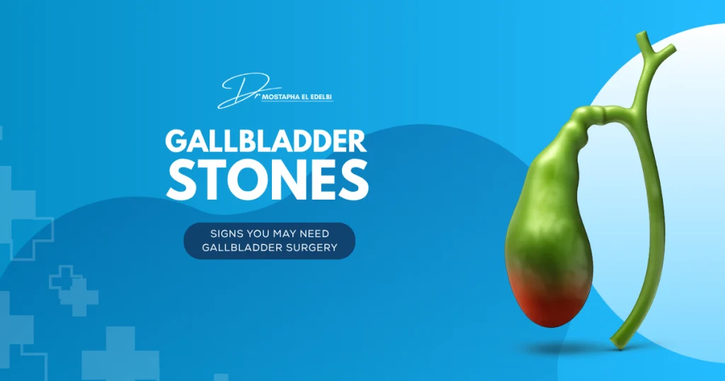 GALLBLADDER-STONES-Signs-You-May-Need-Gallbladder-Surgery.