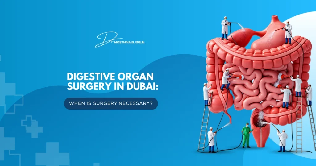 Digestive-Organ-Surgery-in-Dubai-When-Is-Surgery-Necessary