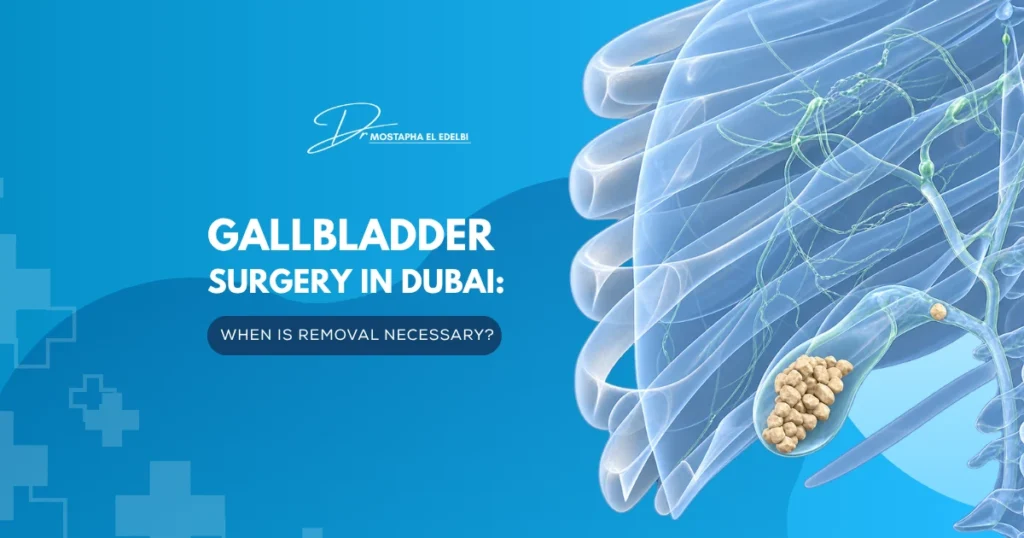 Gallbladder-Surgery-in-Dubai-When-Is-Removal-Necessary