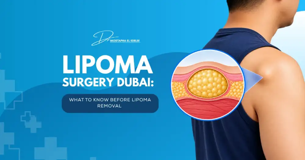 Lipoma-Surgery-Dubai-What-to-Know-Before-Lipoma-Removal